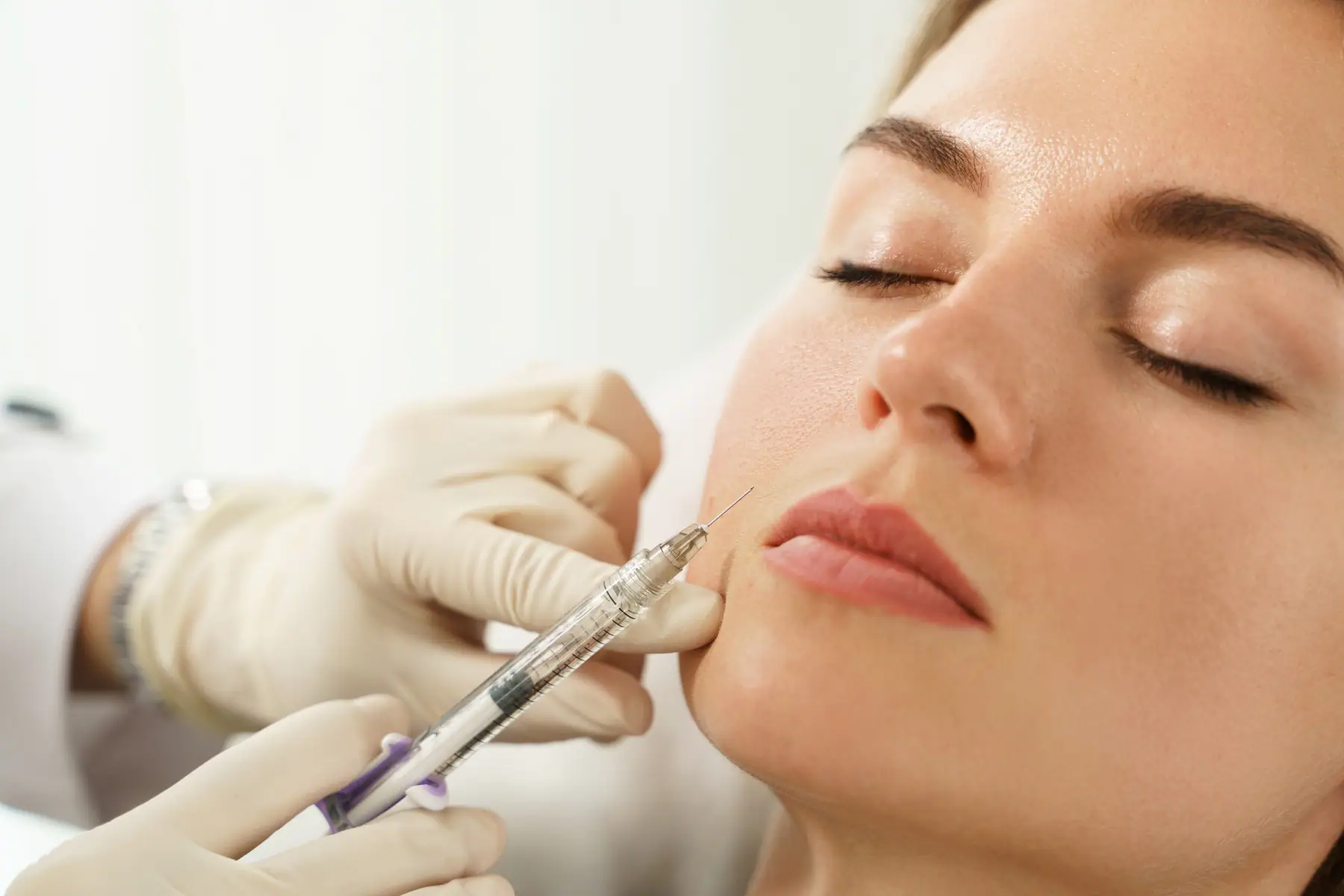 Dermal Fillers in Mount Pleasant, SC